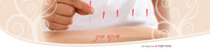 טיפול בדיקור סיני | מרכז דפנה - הבית לרפואה סינית